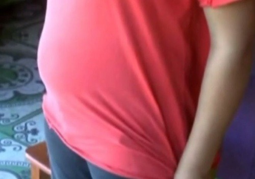 Dievčatko je v piatom mesiaci tehotenstva.