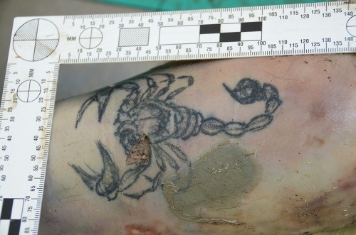 Muž mal škorpióna vytetovaného na vnútornej strane pravého predlaktia