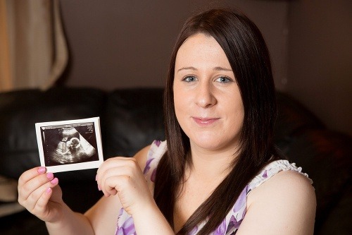 Debbie s ultrazvukom svojho dieťatka