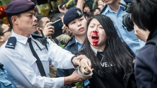 Ng Lai Ying skončila s rozbitou tvárou. Aj tak ju obvinil z toho, že ona napadla policajta.