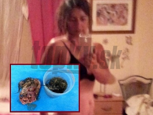 Jenny a nevyvinuté embryo