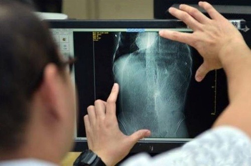 Röntgenová snímka čreva pacienta