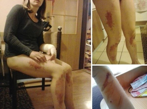 Ako z toho najhoršieho hororu