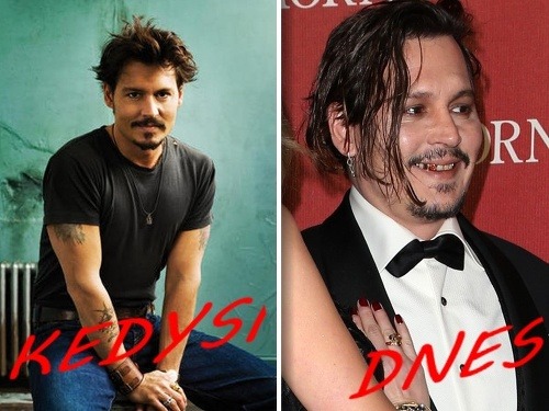 Johnny Depp bol kedysi sexidolom. Dnes vyzerá hrozne. 