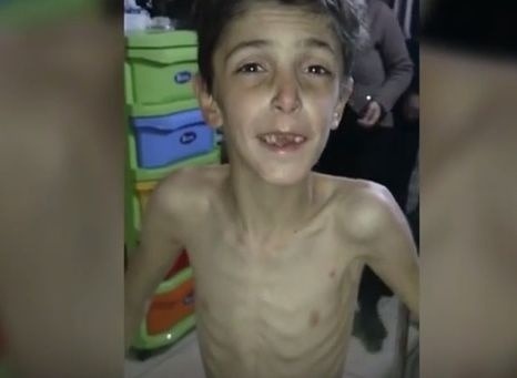 Takto vyzerá sedemročný sýrsky chlapec.