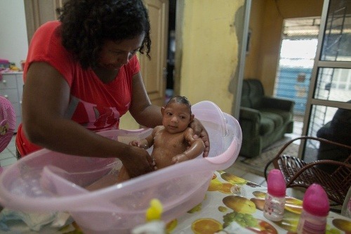 Novorodenec s deformáciou mozgu, ktorého matka sa nakazila vírusom zika