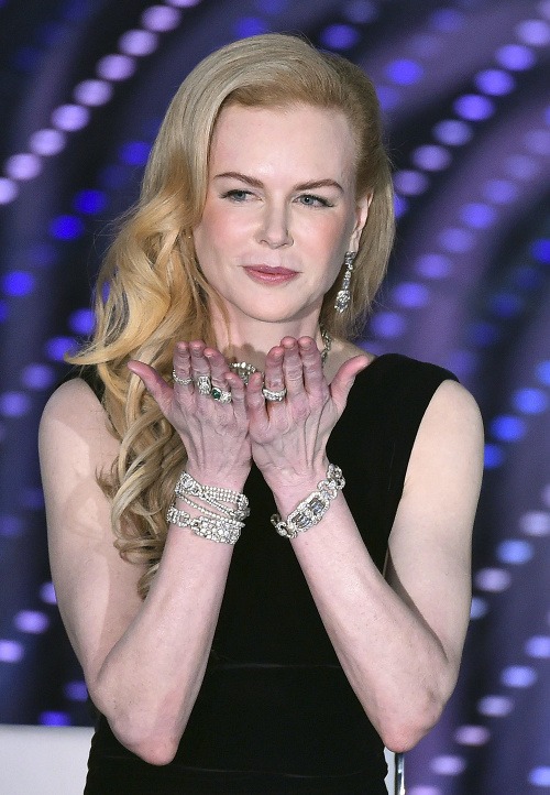 Nicole Kidman má tvár mladice a ruky stareny. 