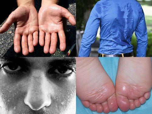 Ilustračný obrázok