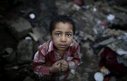 Jemen je po dvoch rokoch občianskej vojny na pokraji hladomoru.