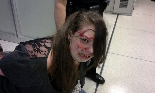 Zranená Hannah na letisku.