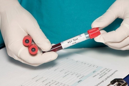 Senzačný objav: Koniec AIDS?