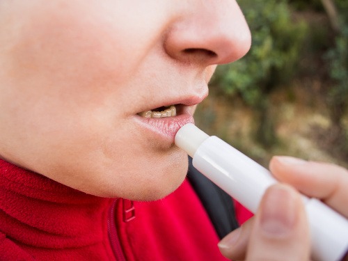 Trápia vás suché pery, najmä v jesennom počasí? Pozrite sa, čo účinne zaberie! 