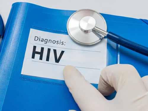 Jedno z najväčších miesto v Rusku postihla epidémia HIV