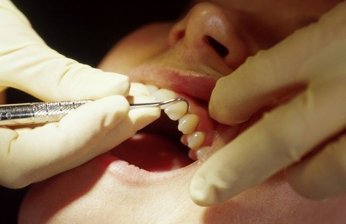 Prichádza revolučná záchrana zubov