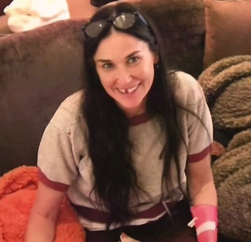 Demi Moore sa so svetom podelila o fotku, na ktorej jej chýba predný zub. Ako prezradila, prišla ešte o jeden. 