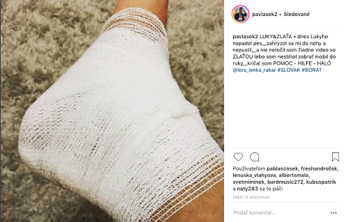 Lukáš Pavlásek skončil po incidente v nemocnici s dohryzenou nohou. 