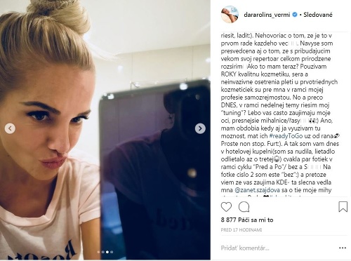 Dara Rolins priznala, že si každého pol roka dáva do čela vpichnúť botox.