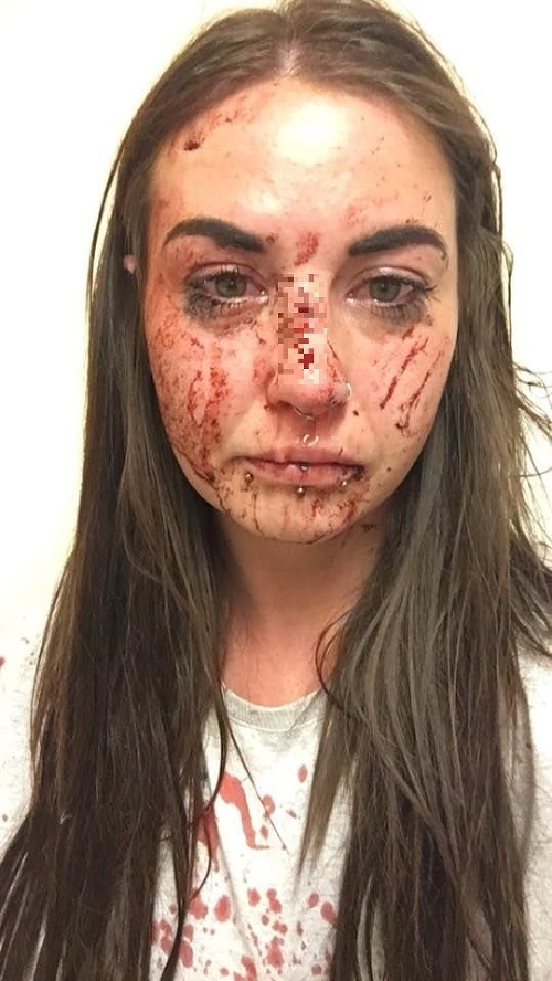 Louise Reedová (27) po útoku. 