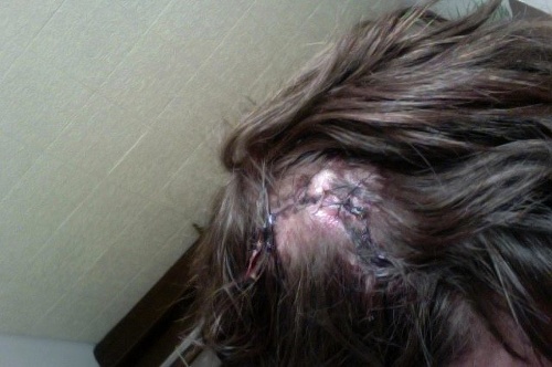 Fotku zranenia zverejnila Kateřina na svojom facebookovom účte.
