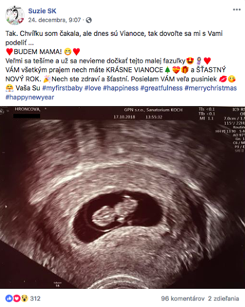 Suzie Hroncová sa na Facebooku pochválila informáciou, že je tehotná.