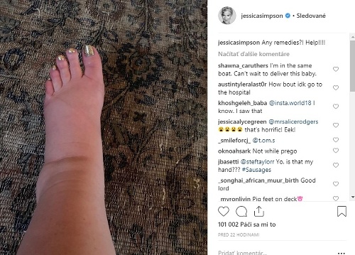 Jessica Simpson sa fanúšikom posťažovala na to, že jej veľmi opúchajú nohy. 