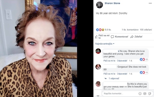 86- ročná mama herečky Sharon Stone je ozaj cica. Obľubuje zvierace vzory a rada sa líči. 