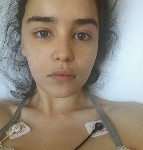 Emila Clarke sa s verejnosťou podelila o fotky z nemocničného lôžka. 