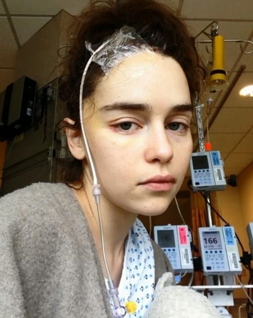 Emilia Clarke prekvapila tým, že zverejnila fotografie z nemocnice. 
