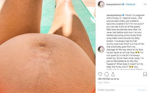 Stacey Solomon zverejnila na instagrame fotku svojho chlpatého tehotenského bruška. 