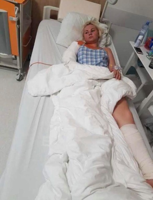 Ivanne Bagovej museli po nehode operovať ruku - pri havárii utrpela zlomeninu. 