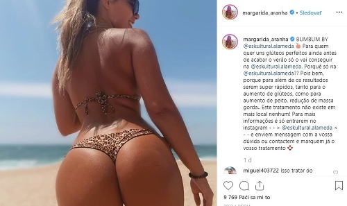 Margarida Aranha má na instagramovom profile už len fotky, na ktorých pretŕča svoje krivky. 