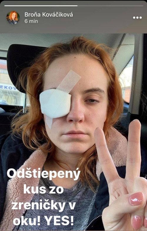 Herečka Bronislava Kováčiková v pondelok informovala, že má poranené oko.