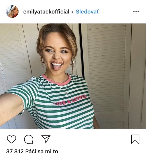 Emily Atack v posledých mesiacoch schudla. 