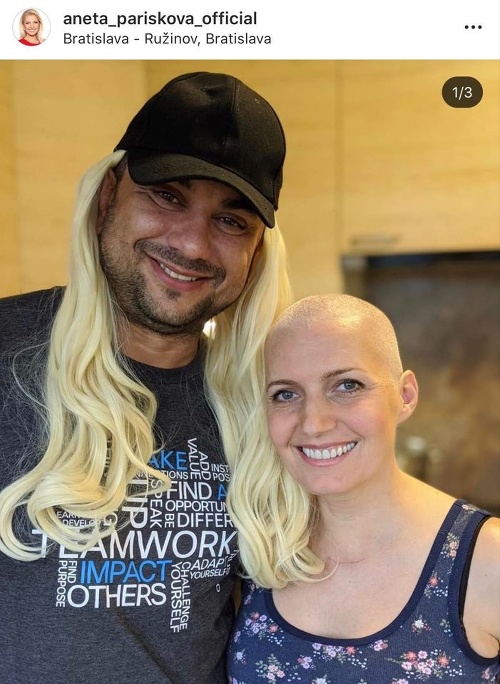 Aneta Parišková sa po chemoterapiách musela vzdať svojich vlasov. 