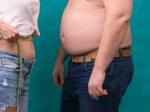 BMI ako rozhodujúci faktor