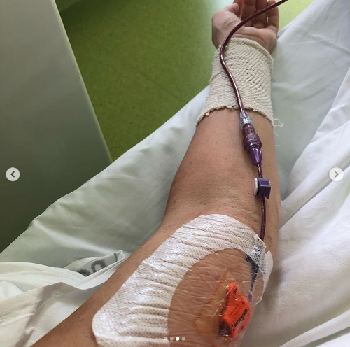 Aneta Parišková absolvovala prvú transfúziu krvi.
