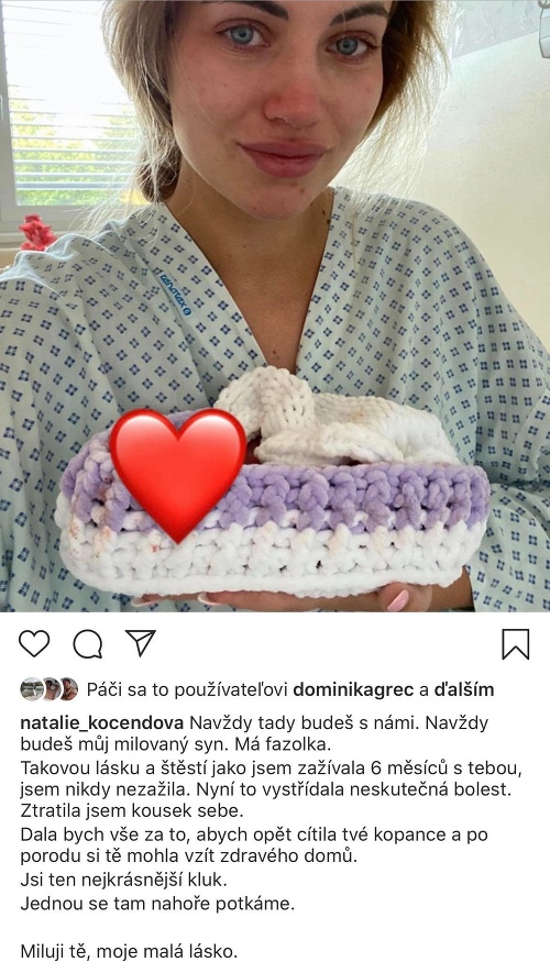 Natálie Kočendová prišla o bábätko v šiestom mesiaci tehotenstva