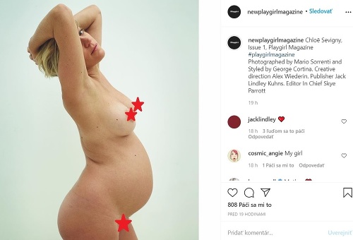 Chloë Sevigny počas tehotenstva nafotila takéto odvážne zábery. 