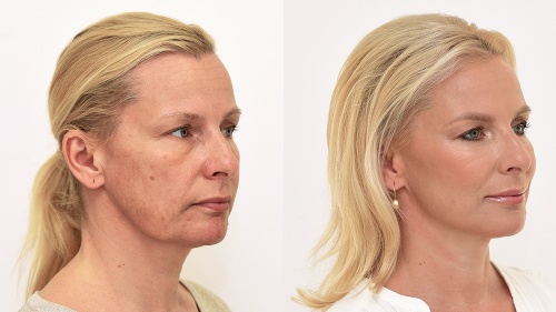 Nová oáza krásy a