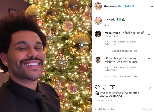 Počas vianočných sviatkov ukázal The Weeknd fanúšikom svoju normálnu podobu. 