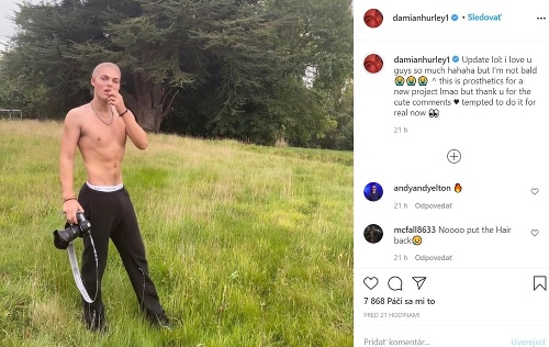 Damian Hurley sa na Instagrame pochválil fotkou bez vlasov.