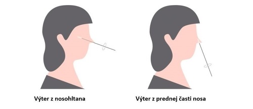 Pre Slovensko sú dostupné