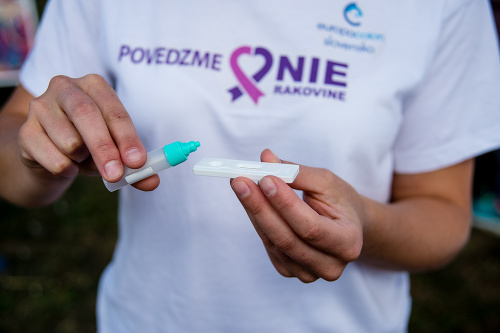 RAKOVINA sa Covidu nezľakla