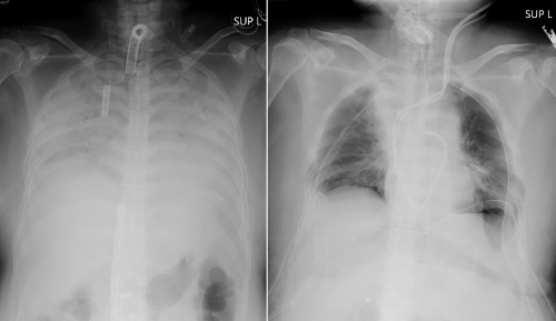 Kombinácia röntgenových snímok poskytnutých