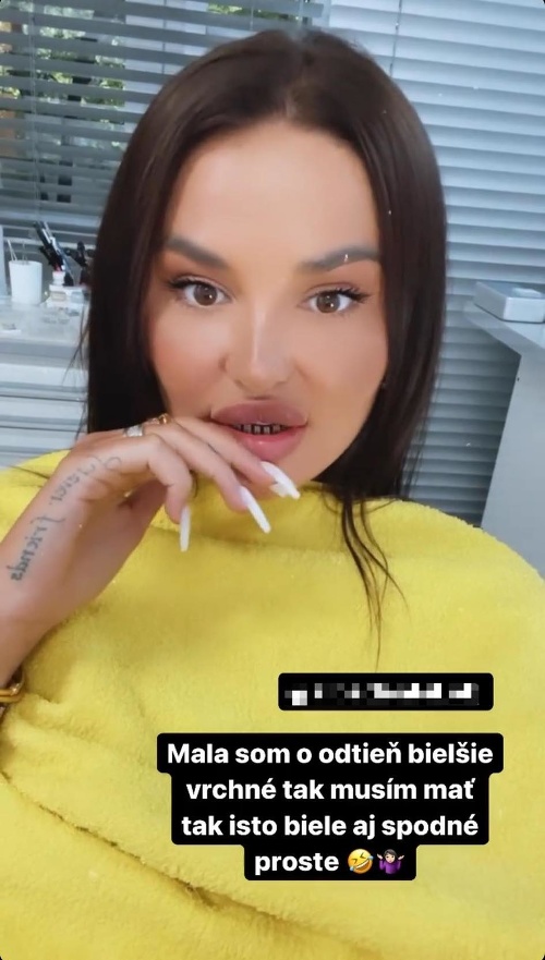 Zuzana Plačková nemala problém odhaliť na Instagrame aj svoje obrúsené zuby.