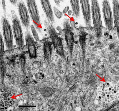 Snímka z elektrónového mikrosnímku priedušky po infekcii SARS-CoV-2. (červené šípky zobrazujú vírusové častice)