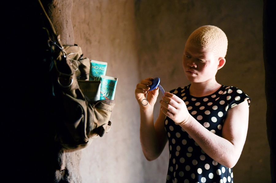 Catherine ukazuje alarm vo svojom dome v meste Machinga na juhovýchode afrického štátu Malawi.