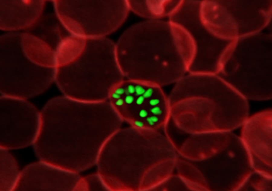 Maláriu spôsobujú parazitické prvoky z rodu Plasmodium