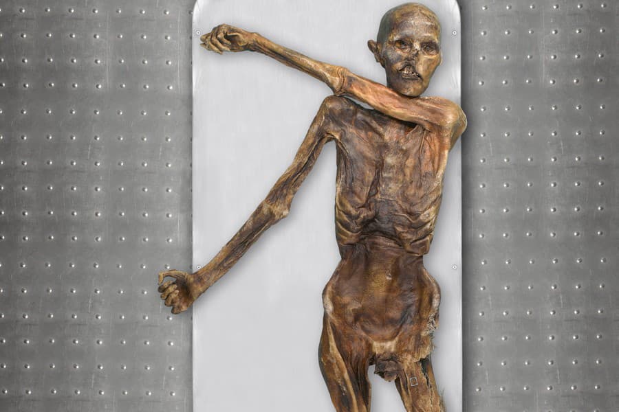 Ľadový muž Ötzi mal