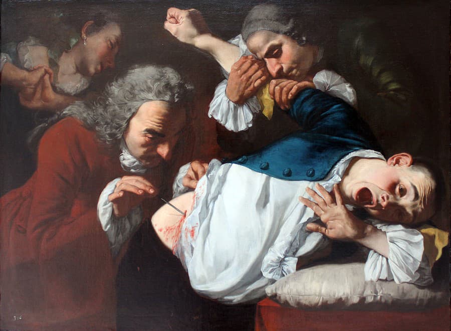 Operácia na maľbe G. Traversiho, 1753/54